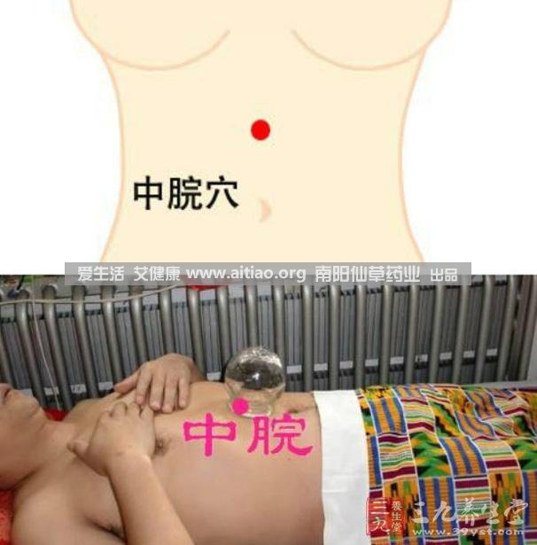 中脘穴位于腹部正中線(xiàn)，臍上4寸的位置上。每天艾灸10-15分鐘，能有效緩解胃部不適的癥狀，同時(shí)有助于祛濕。